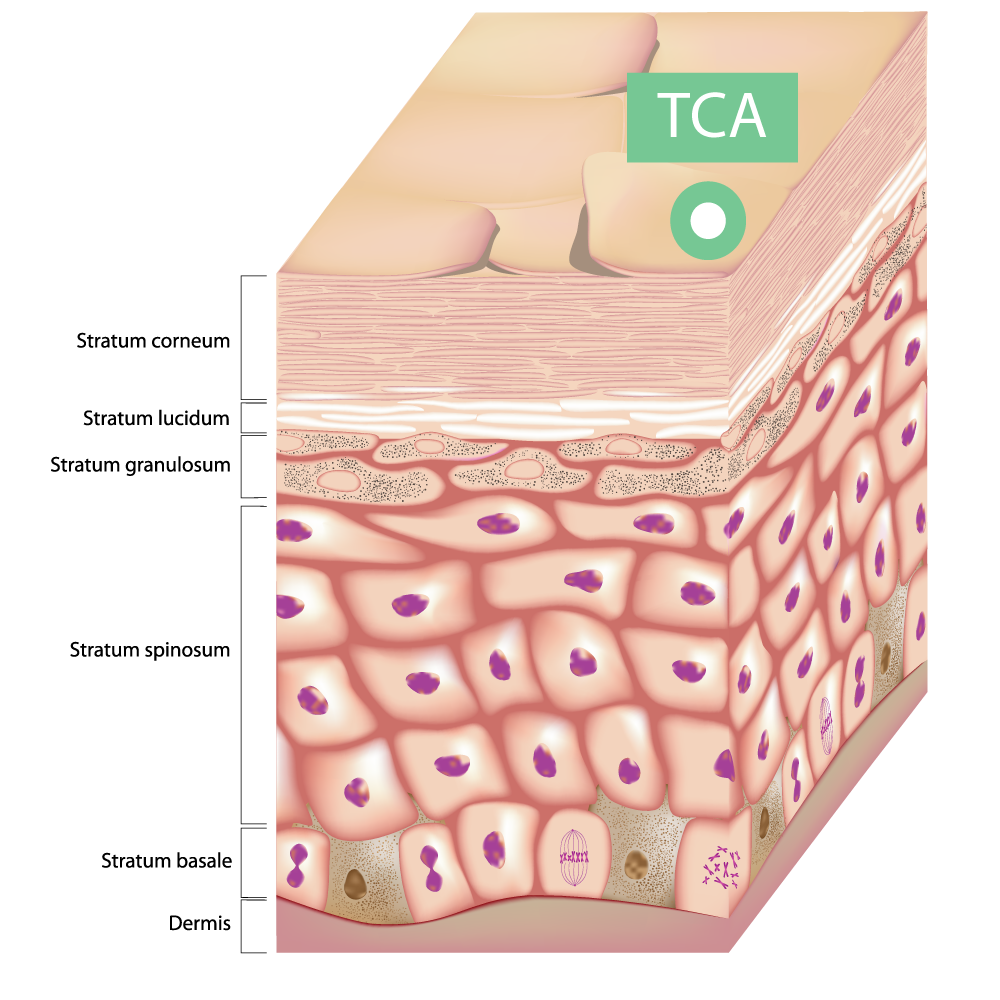 TCA